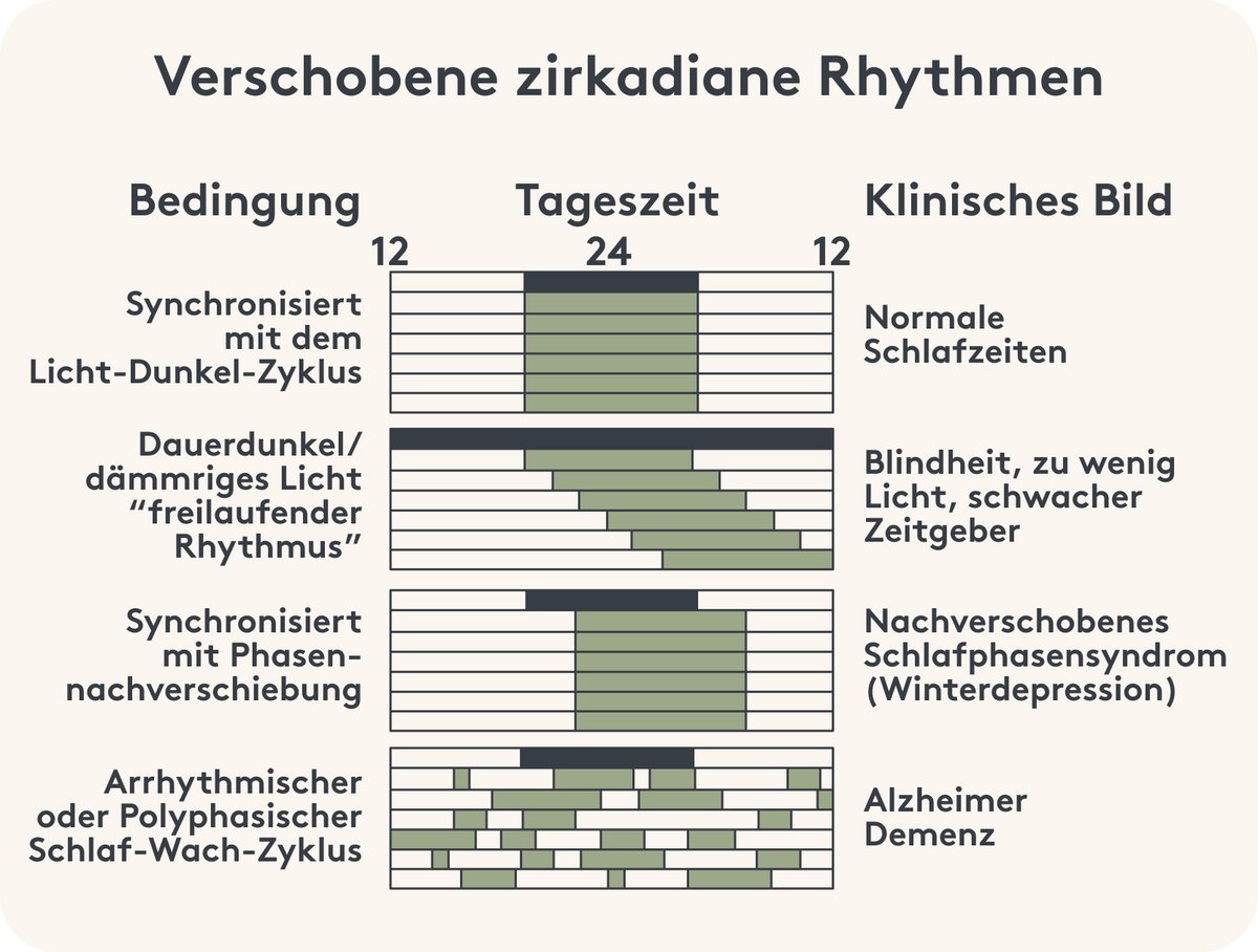 Grafische Darstellung eines verschobenen zirkadianen Rhythmus